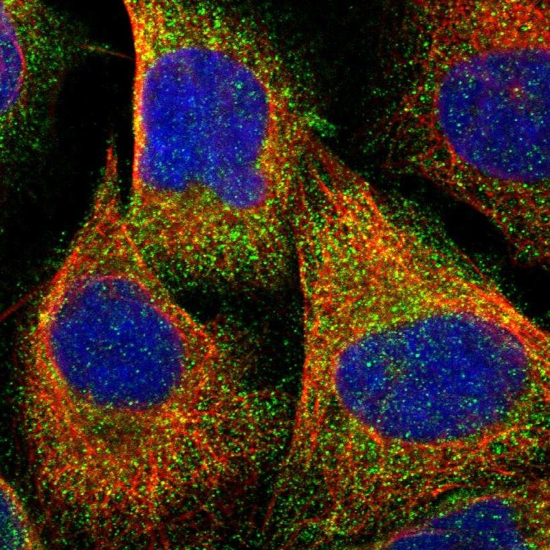 NAPE-PLD Antibody - BSA Free Immunocytochemistry/ Immunofluorescence: NAPE-PLD Antibody [NBP1-88248]
