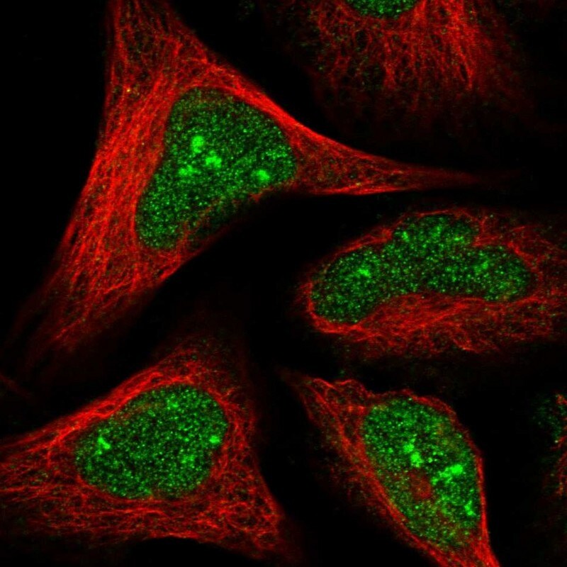 HD domain containing 2 Antibody - BSA Free Immunocytochemistry/ Immunofluorescence: HD domain containing 2 Antibody [NBP1-88251]