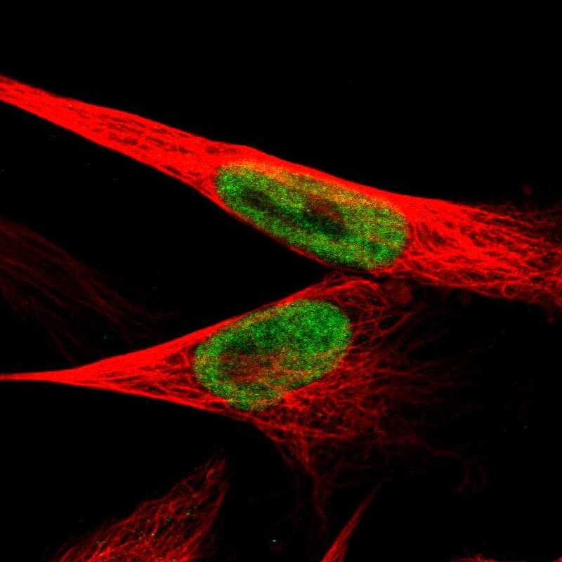 JMJD1B Antibody - BSA Free Immunocytochemistry/ Immunofluorescence: JMJD1B Antibody - BSA Free [NBP1-88256]