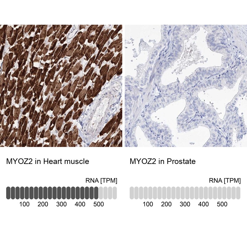 Myozenin 2 Antibody - BSA Free Immunohistochemistry-Paraffin: Myozenin 2 Antibody - BSA Free [NBP1-88259]