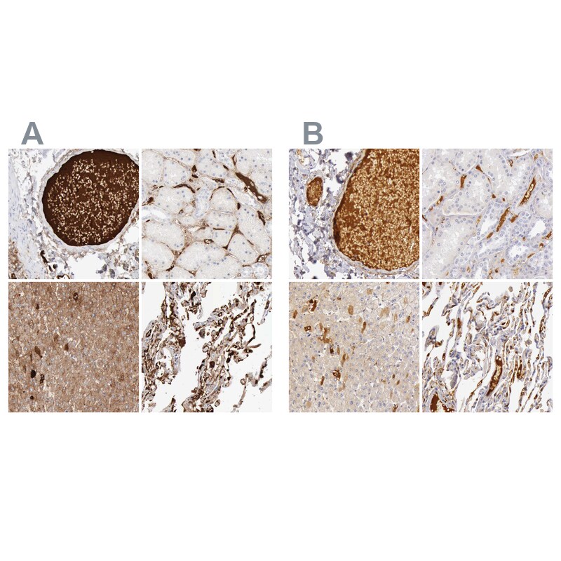 C4 binding protein A Antibody - BSA Free Immunohistochemistry-Paraffin: C4 binding protein A Antibody - BSA Free [NBP1-88263]