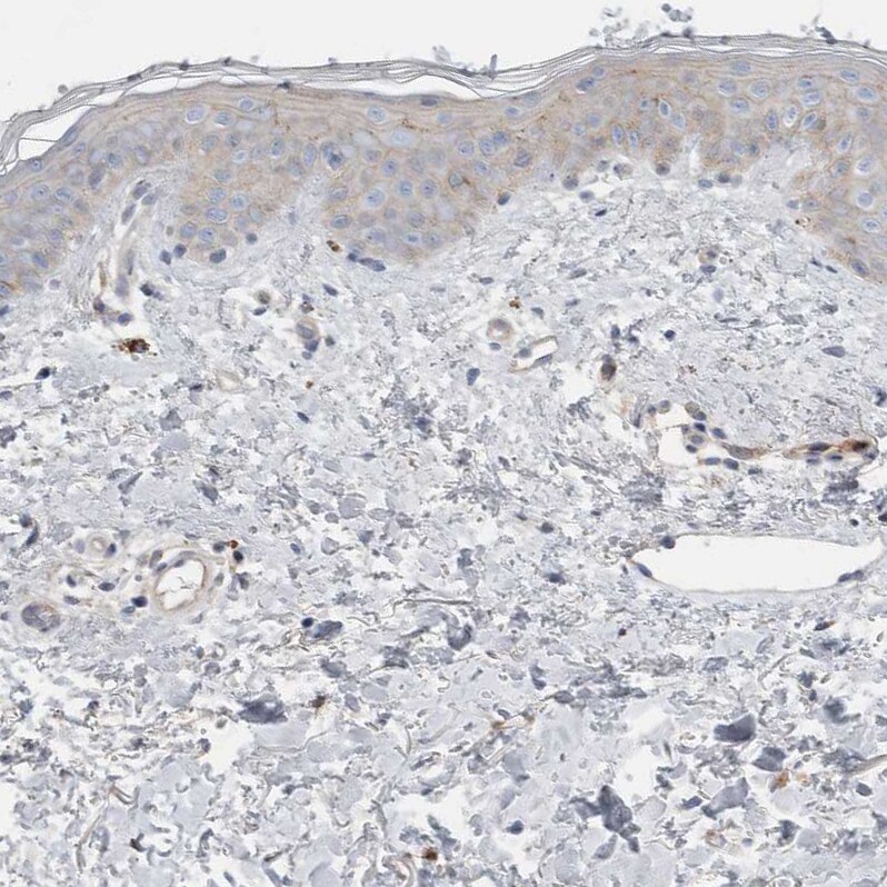 Complement Factor I Antibody Immunohistochemistry-Paraffin: Complement Factor I Antibody [NBP1-88267]