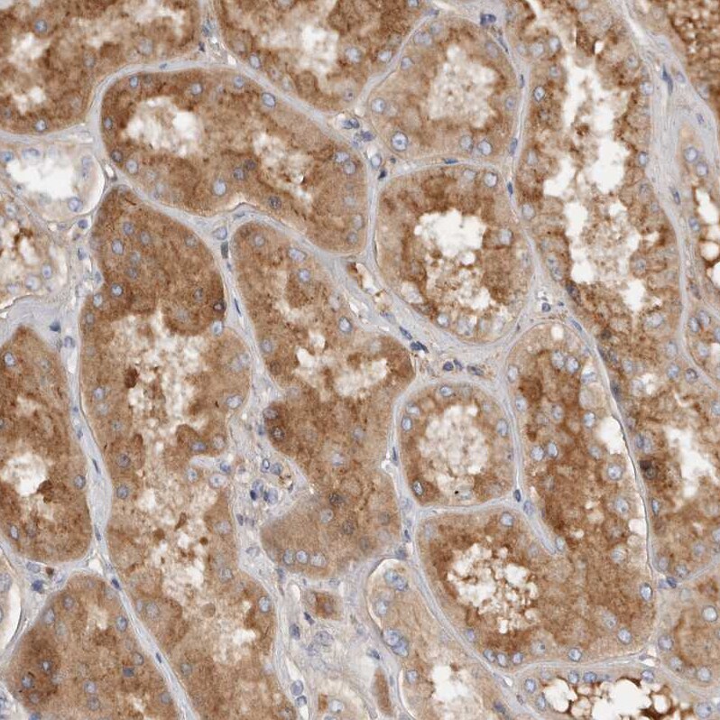 Complement Factor I Antibody Immunohistochemistry-Paraffin: Complement Factor I Antibody [NBP1-88267]