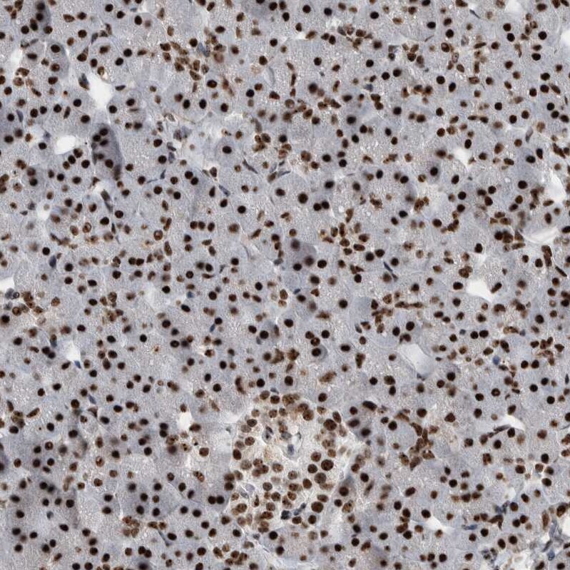 Nucleolin Antibody - BSA Free Immunohistochemistry-Paraffin: Nucleolin Antibody - BSA Free [NBP1-88271]