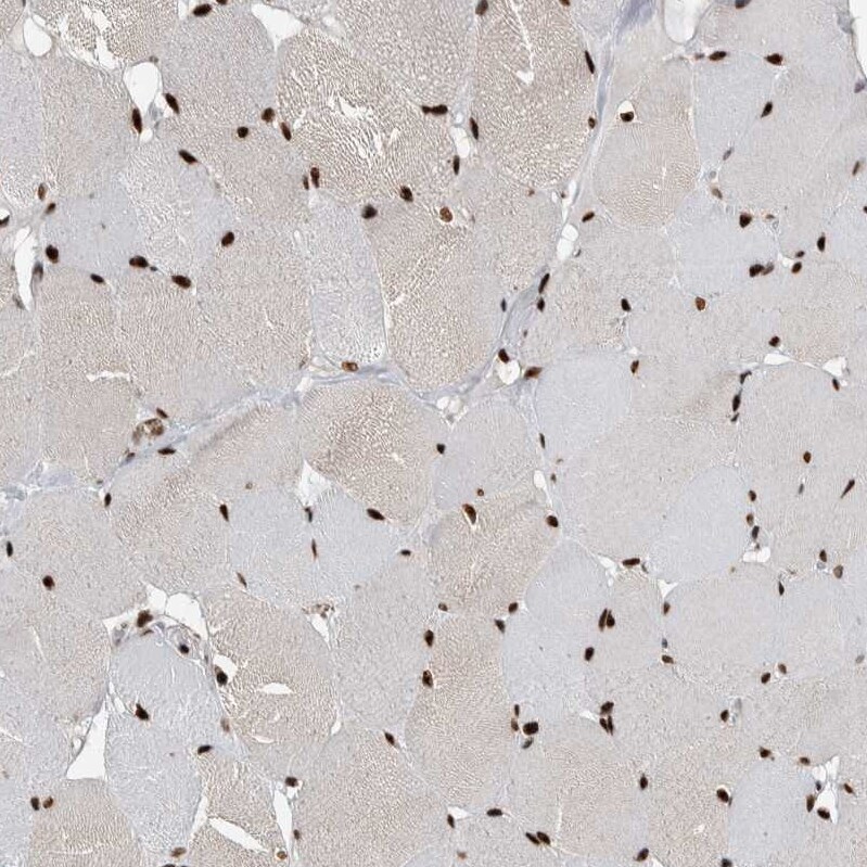 Nucleolin Antibody - BSA Free Immunohistochemistry-Paraffin: Nucleolin Antibody - BSA Free [NBP1-88271]
