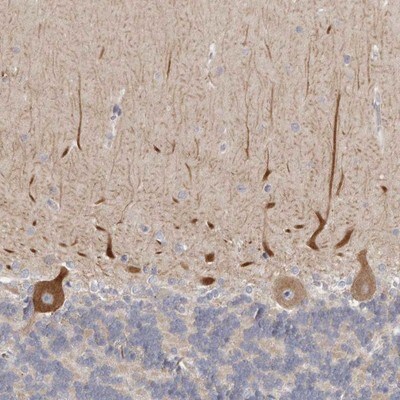 C21orf59 Antibody - BSA Free Immunohistochemistry-Paraffin: C21orf59 Antibody - BSA Free [NBP1-88275]