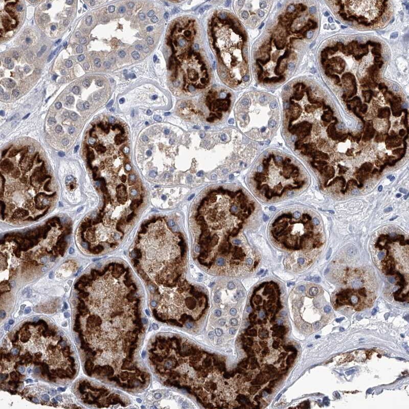 Pyridoxal Kinase/PDXK Antibody - BSA Free Immunohistochemistry-Paraffin: Pyridoxal Kinase/PDXK Antibody [NBP1-88282]