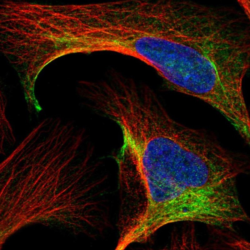 CCT8 Antibody - BSA Free Immunocytochemistry/ Immunofluorescence: CCT8 Antibody [NBP1-88286]