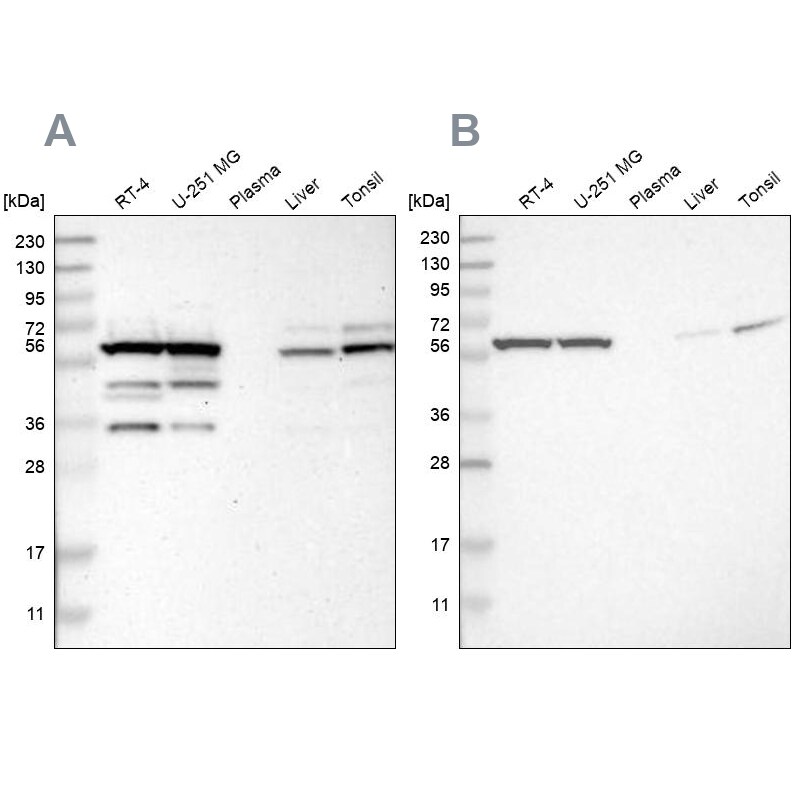 CCT8 Antibody - BSA Free Western Blot: CCT8 Antibody - BSA Free [NBP1-88287]