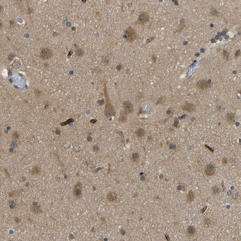 CCT8 Antibody - BSA Free Immunohistochemistry-Paraffin: CCT8 Antibody - BSA Free [NBP1-88287]