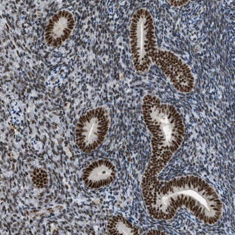 URB1 Antibody - BSA Free Immunohistochemistry-Paraffin: URB1 Antibody - BSA Free [NBP1-88288]