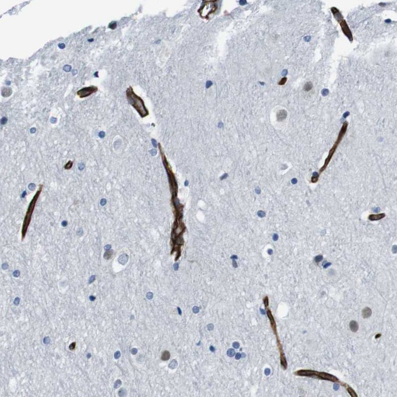 HspA12B Antibody - BSA Free Immunohistochemistry-Paraffin: HspA12B Antibody - BSA Free [NBP1-88293]