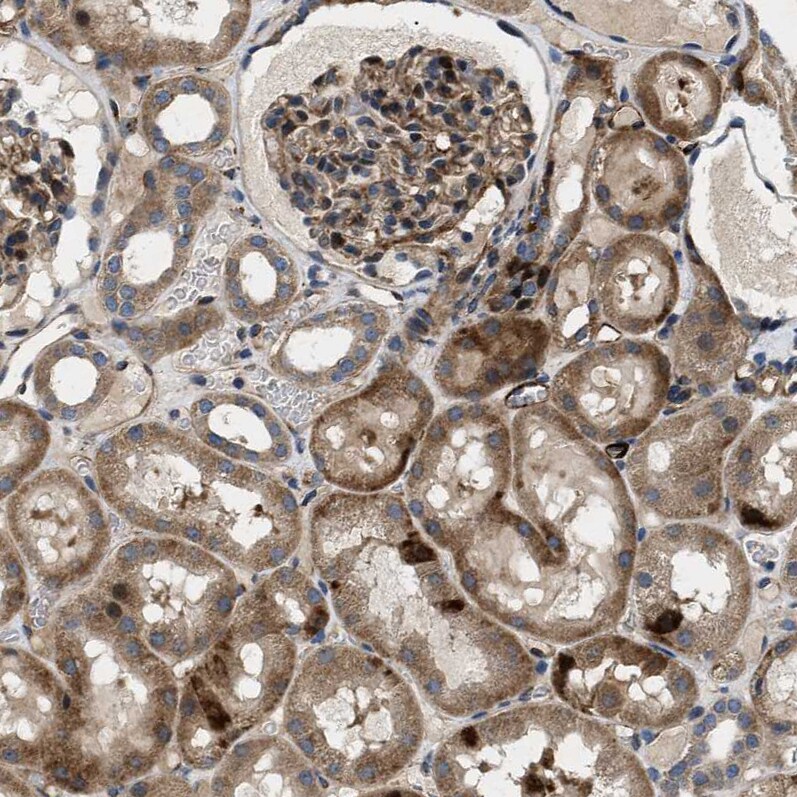 HspA12B Antibody - BSA Free Immunohistochemistry-Paraffin: HspA12B Antibody - BSA Free [NBP1-88294]