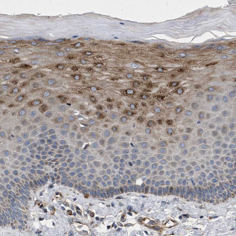HspA12B Antibody - BSA Free Immunohistochemistry-Paraffin: HspA12B Antibody - BSA Free [NBP1-88294]