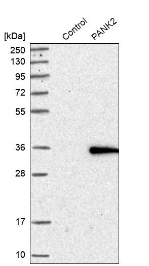 PANK2 Antibody - BSA Free Western Blot: PANK2 Antibody - BSA Free [NBP1-88295]