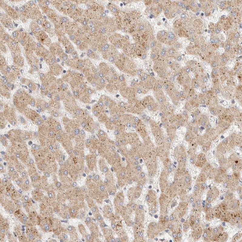 ITPA Antibody - BSA Free Immunohistochemistry-Paraffin: ITPA Antibody - BSA Free [NBP1-88296]