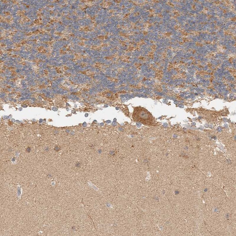 ITPA Antibody - BSA Free Immunohistochemistry-Paraffin: ITPA Antibody - BSA Free [NBP1-88296]