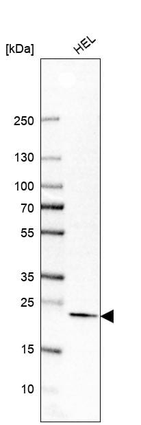 ITPA Antibody - BSA Free Western Blot: ITPA Antibody - BSA Free [NBP1-88296]