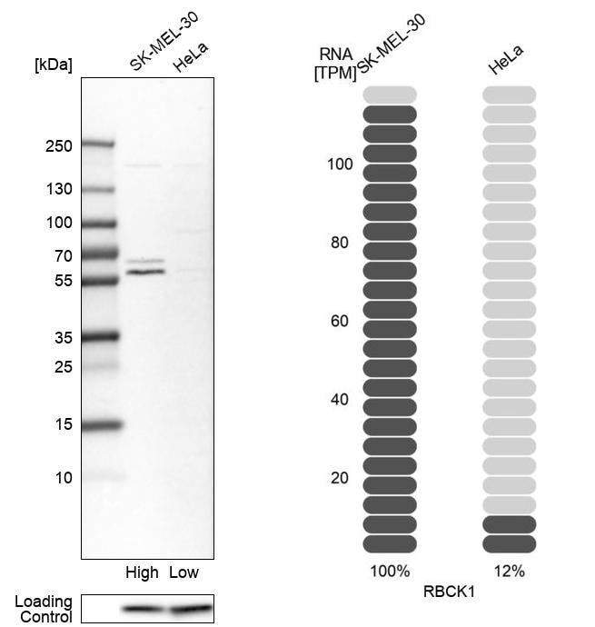 RBCK1 Antibody - BSA Free Western Blot: RBCK1 Antibody - BSA Free [NBP1-88301]