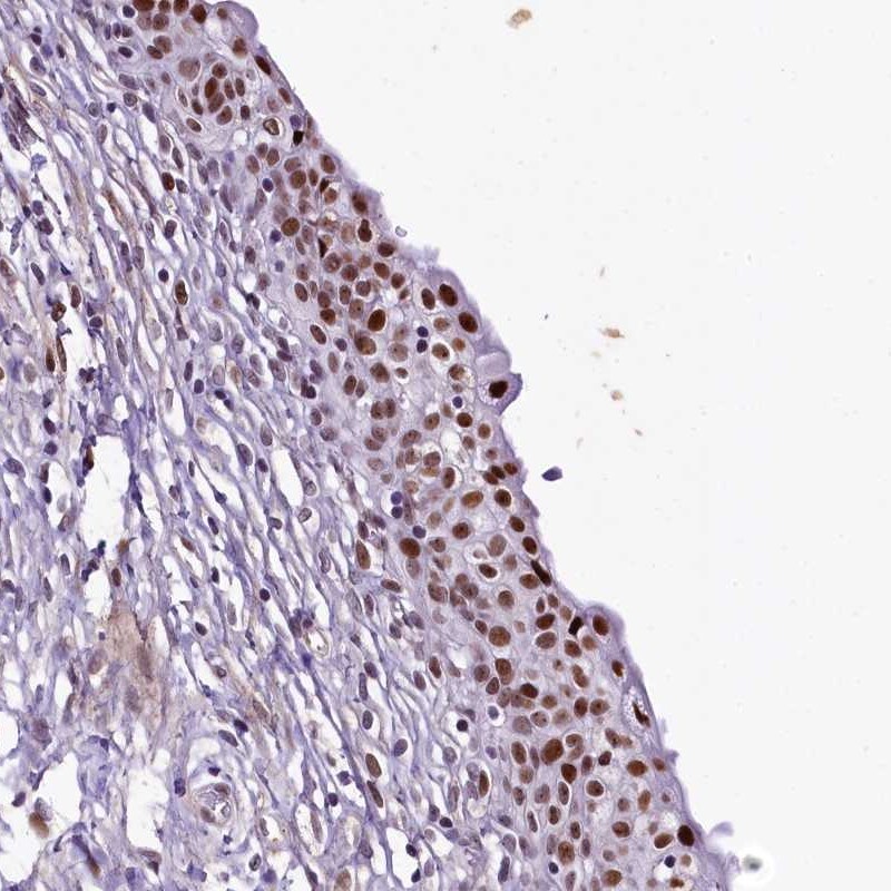 SAMD10 Antibody - BSA Free Immunohistochemistry-Paraffin: SAMD10 Antibody [NBP1-88305]