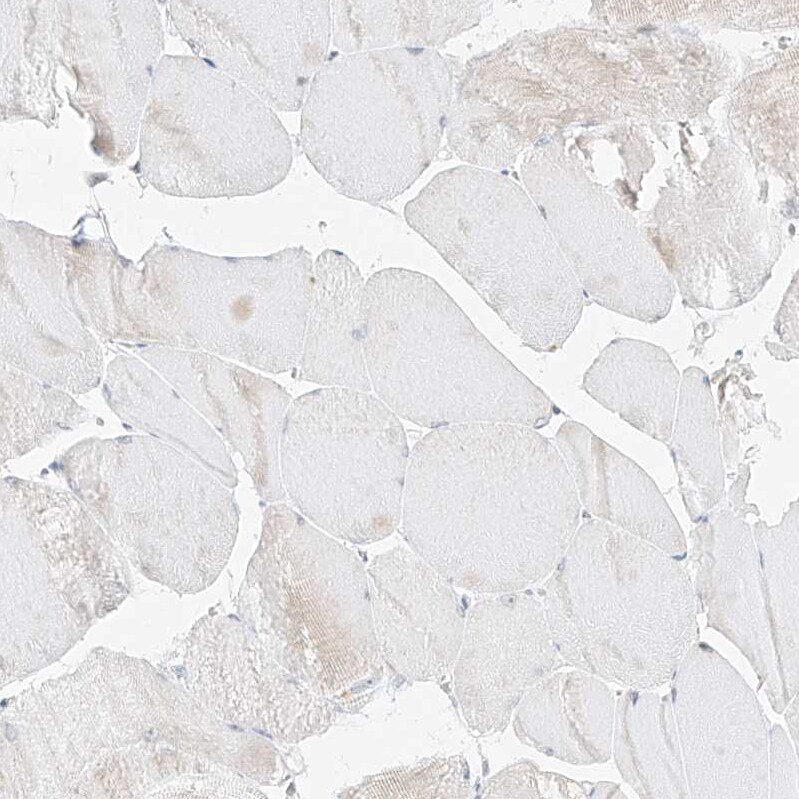 TASP1 Antibody - BSA Free Immunohistochemistry-Paraffin: TASP1 Antibody - BSA Free [NBP1-88306]