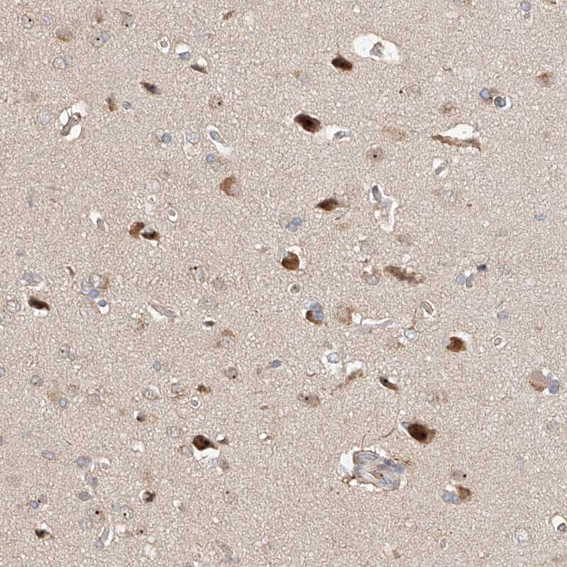 TASP1 Antibody - BSA Free Immunohistochemistry-Paraffin: TASP1 Antibody - BSA Free [NBP1-88306]