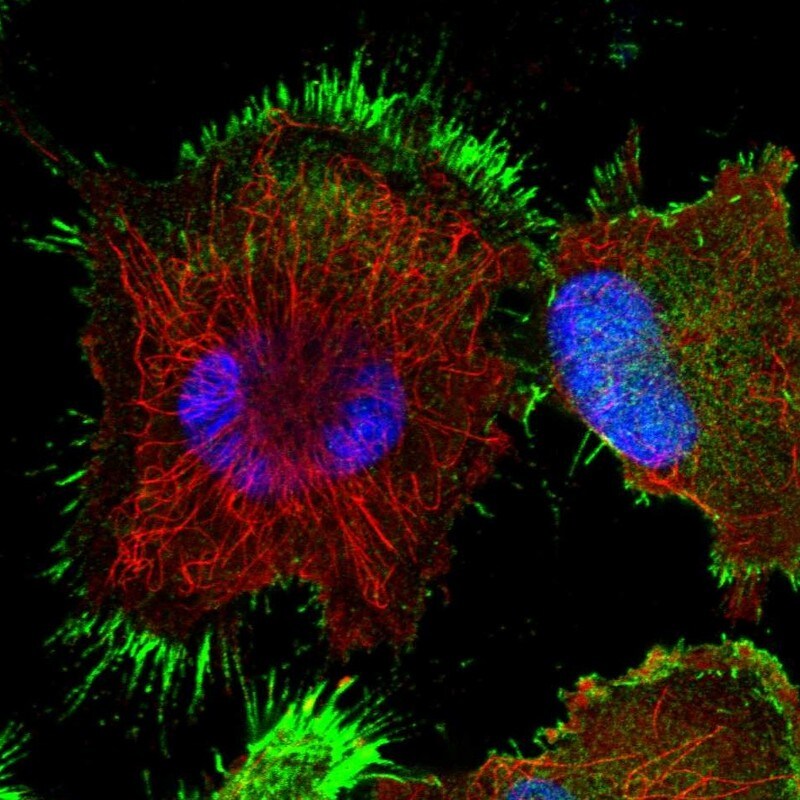 TASP1 Antibody - BSA Free Immunocytochemistry/ Immunofluorescence: TASP1 Antibody [NBP1-88307]
