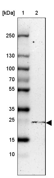 NTPCR Antibody - BSA Free Western Blot: NTPCR Antibody - BSA Free [NBP1-88331]