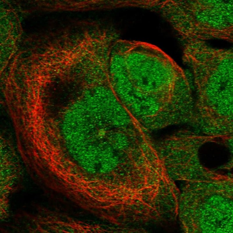 HspB11 Antibody - BSA Free Immunocytochemistry/ Immunofluorescence: HspB11 Antibody - BSA Free [NBP1-88332]