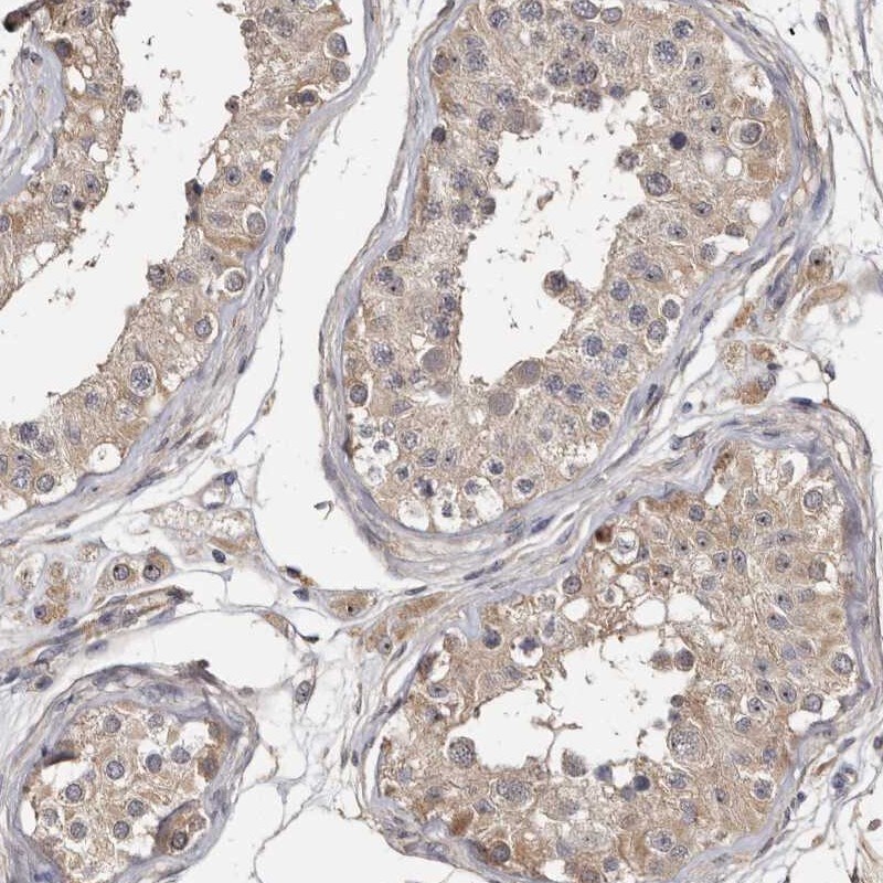 TTC39A Antibody - BSA Free Immunohistochemistry-Paraffin: TTC39A Antibody - BSA Free [NBP1-88333]