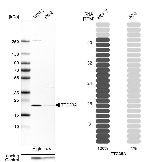 TTC39A Antibody - BSA Free Western Blot: TTC39A Antibody - BSA Free [NBP1-88333]