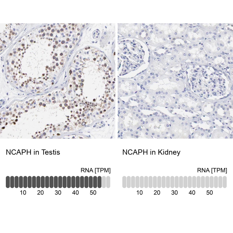 NCAPH Antibody - BSA Free Immunohistochemistry-Paraffin: NCAPH Antibody [NBP1-88345]
