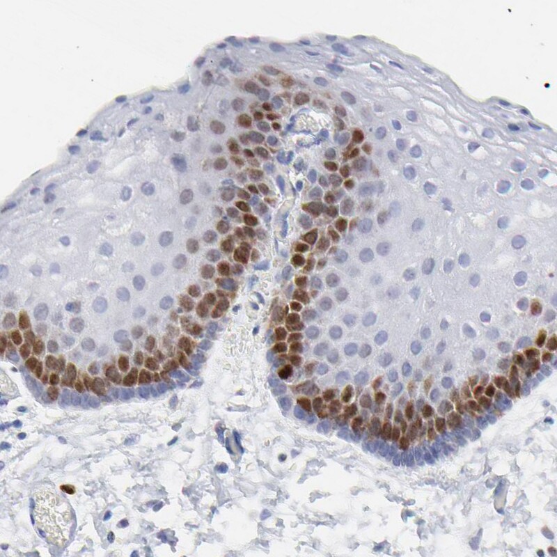 NCAPH Antibody - BSA Free Immunohistochemistry-Paraffin: NCAPH Antibody [NBP1-88345]