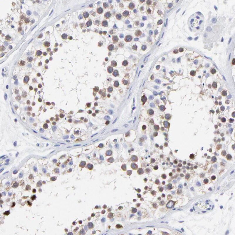 NCAPH Antibody - BSA Free Immunohistochemistry-Paraffin: NCAPH Antibody [NBP1-88345]