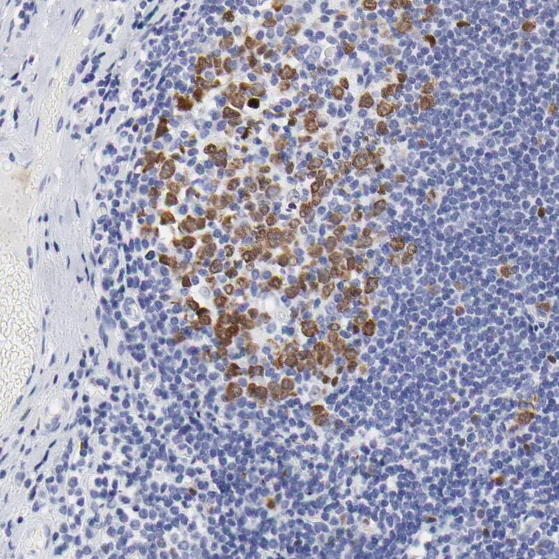 NCAPH Antibody - BSA Free Immunohistochemistry-Paraffin: NCAPH Antibody [NBP1-88345]