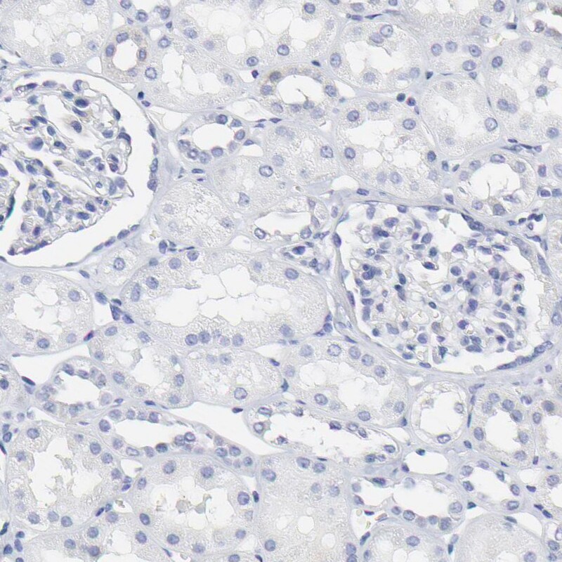 NCAPH Antibody - BSA Free Immunohistochemistry-Paraffin: NCAPH Antibody [NBP1-88345]