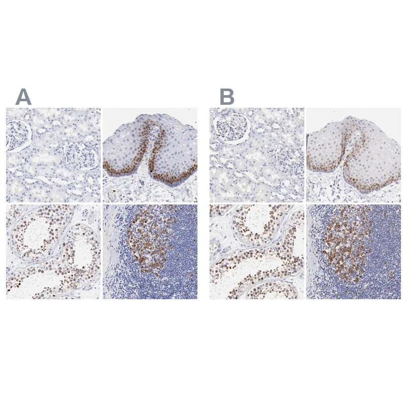 NCAPH Antibody - BSA Free Immunohistochemistry-Paraffin: NCAPH Antibody [NBP1-88345]
