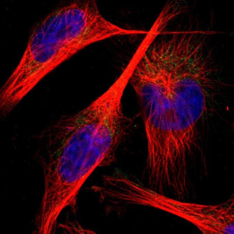 PNKD Antibody - BSA Free Immunocytochemistry/ Immunofluorescence: PNKD Antibody - BSA Free [NBP1-88348]