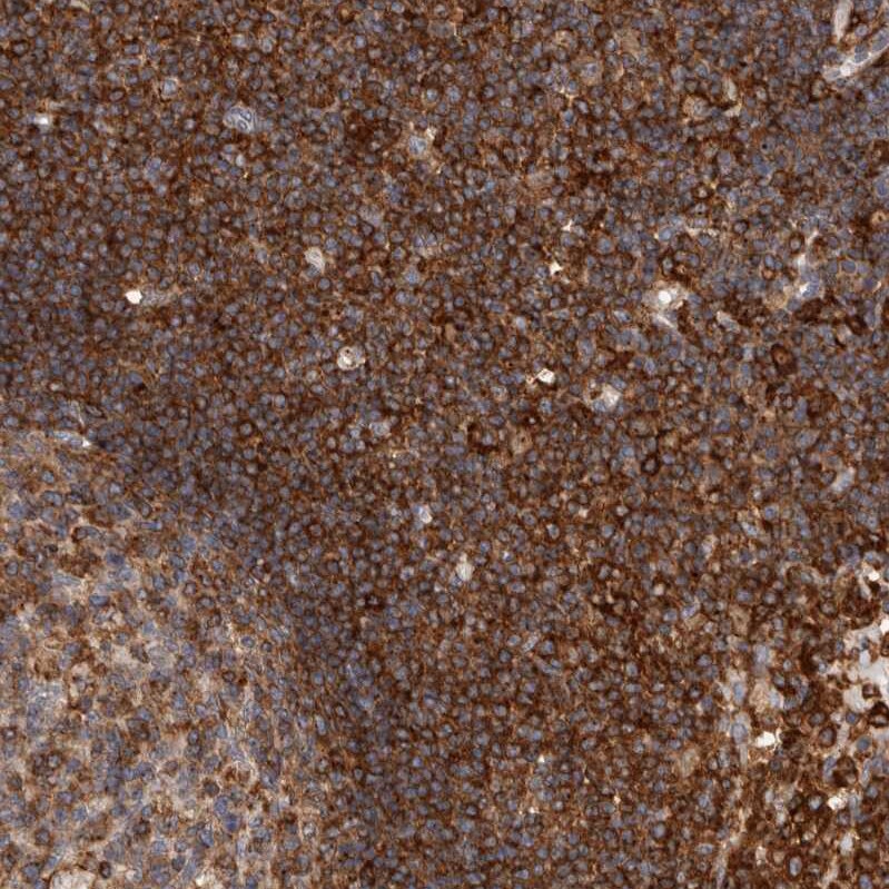 CCDC88B Antibody - BSA Free Immunohistochemistry-Paraffin: CCDC88B Antibody - BSA Free [NBP1-88350]