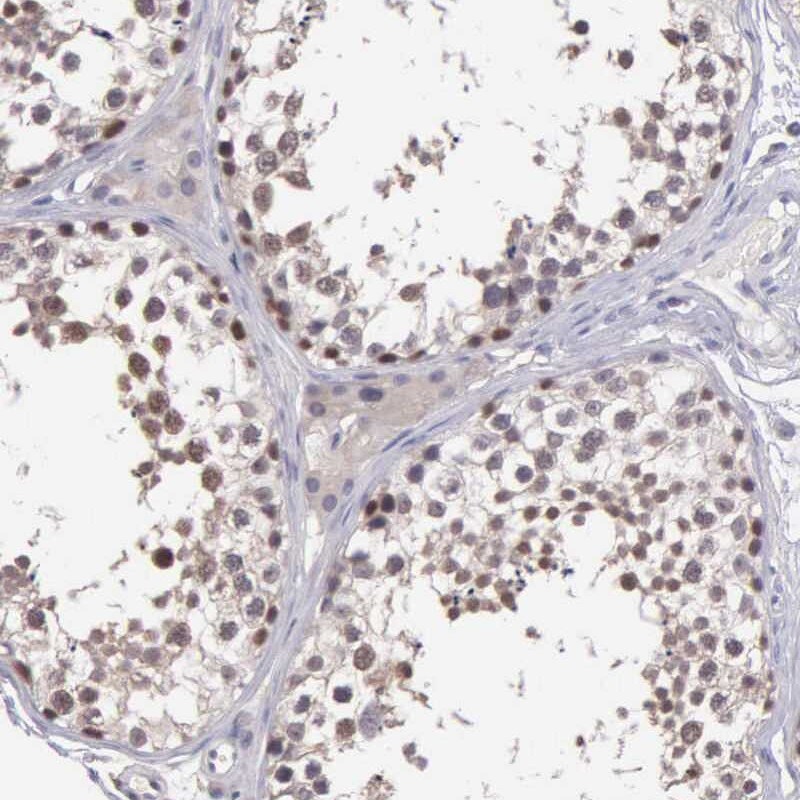 BRD1 Antibody - BSA Free Immunohistochemistry: BRD1 Antibody - BSA Free [NBP1-88352]