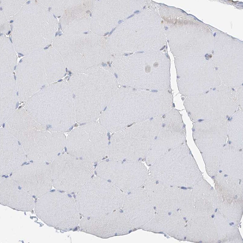 ITM2B Antibody - BSA Free Immunohistochemistry-Paraffin: ITM2B Antibody [NBP1-88354]