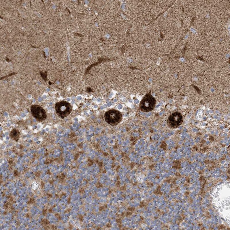 ITM2B Antibody - BSA Free Immunohistochemistry-Paraffin: ITM2B Antibody [NBP1-88354]
