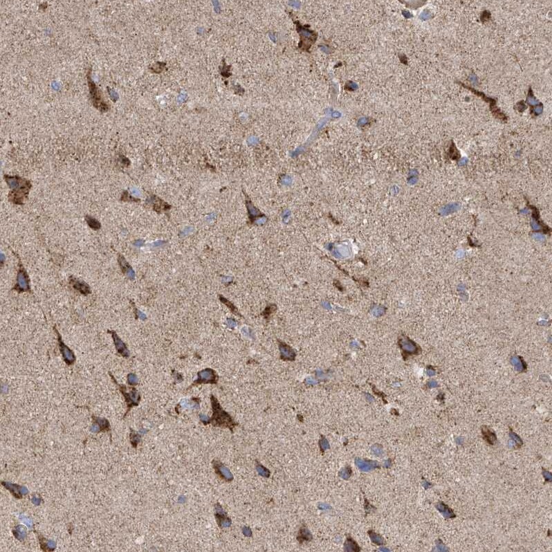 ITM2B Antibody - BSA Free Immunohistochemistry-Paraffin: ITM2B Antibody [NBP1-88354]