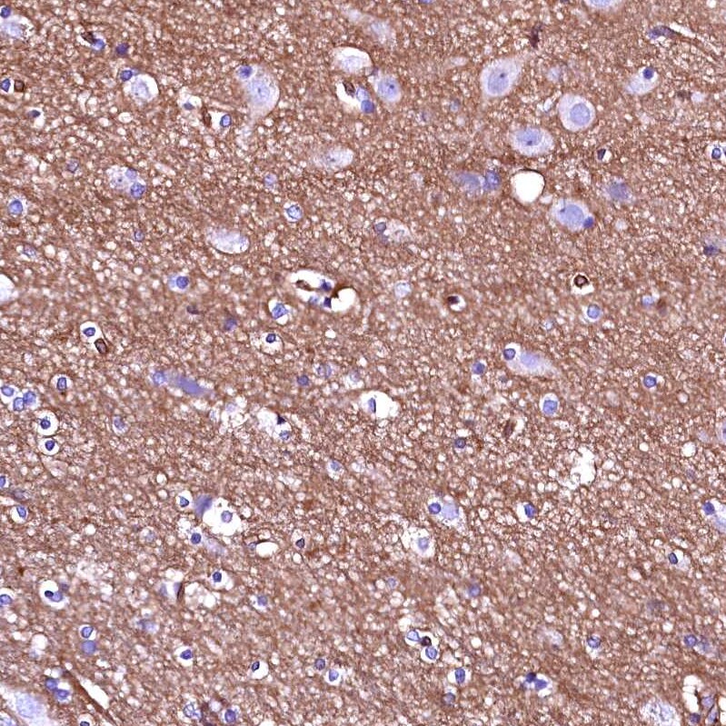 ANKRD32 Antibody - BSA Free Immunohistochemistry: ANKRD32 Antibody - BSA Free [NBP1-88358]