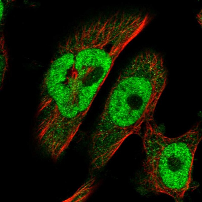 BRCA2 Antibody - BSA Free Immunocytochemistry/ Immunofluorescence: BRCA2 Antibody [NBP1-88361]
