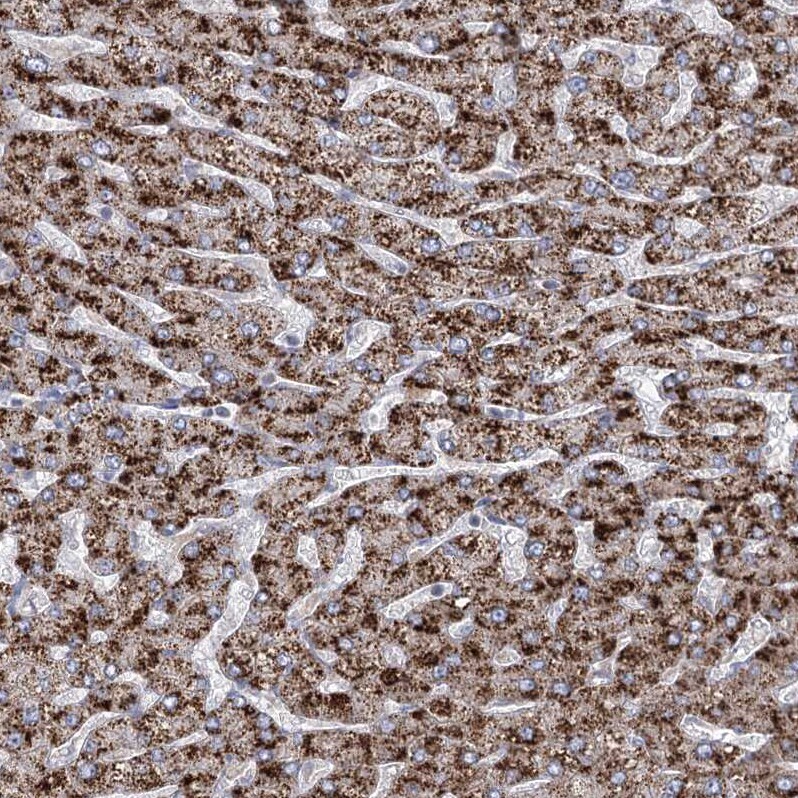 ACOX2 Antibody - BSA Free Immunohistochemistry-Paraffin: ACOX2 Antibody - BSA Free [NBP1-88364]