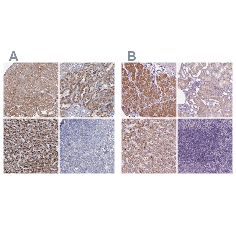 ACOX2 Antibody - BSA Free Immunohistochemistry-Paraffin: ACOX2 Antibody - BSA Free [NBP1-88364]