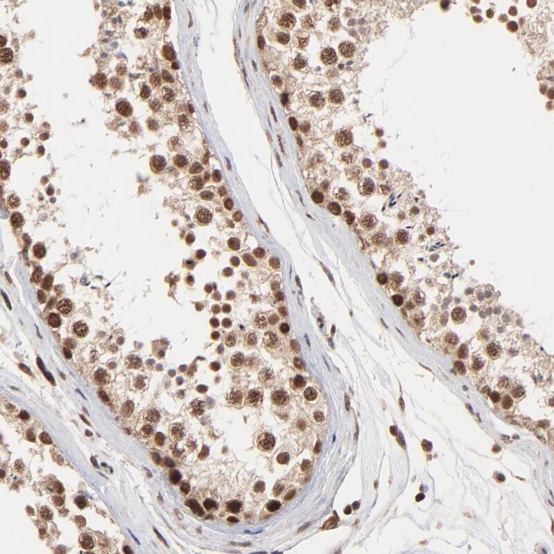 BRPF1 Antibody - BSA Free Immunohistochemistry-Paraffin: BRPF1 Antibody - BSA Free [NBP1-88369]