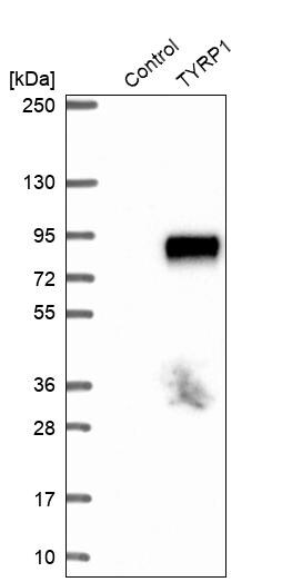 TYRP1 Antibody - BSA Free Western Blot: TYRP1 Antibody - BSA Free [NBP1-88370]