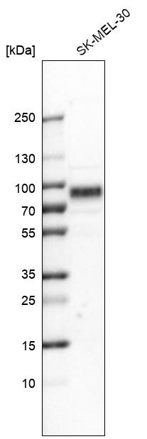 TYRP1 Antibody - BSA Free Western Blot: TYRP1 Antibody - BSA Free [NBP1-88370]